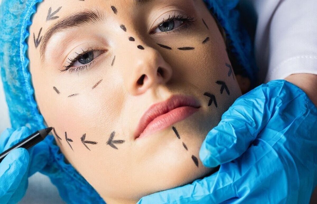 سن انجام عمل‌های زیبایی به زیر ۱۴ سال رسید

