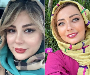 بازیگران زن ایرانی که کتک خوردند! + عکس گریم‌های جنجالی 
