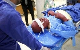 ۵ نکته مهم هنگام وقوع حادثه در چهارشنبه سوری